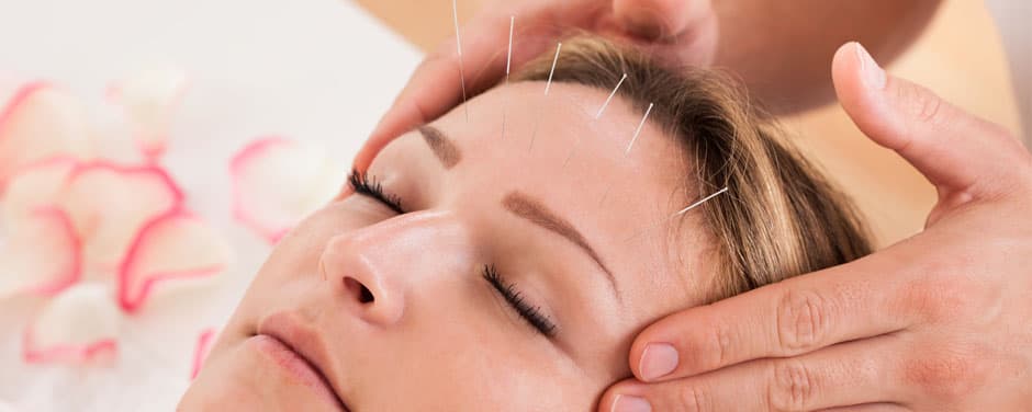 Os benefícios da acupuntura no tratamento de traumas físicos e emocionais