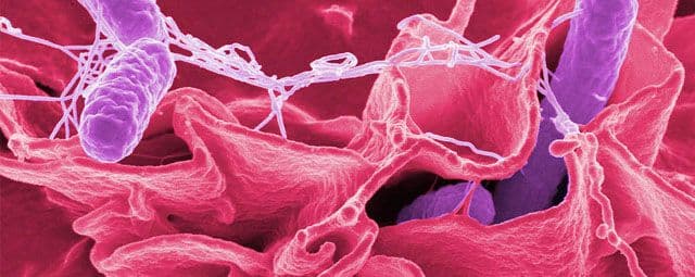 O que é salmonela ou salmonelose?